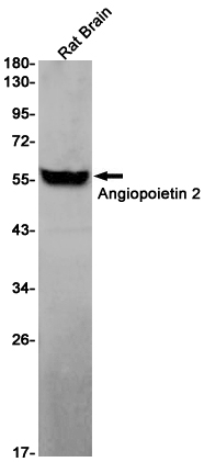 Angiopoietin 2 Rabbit mAb